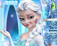 lnyos - Elsa rejuvenation